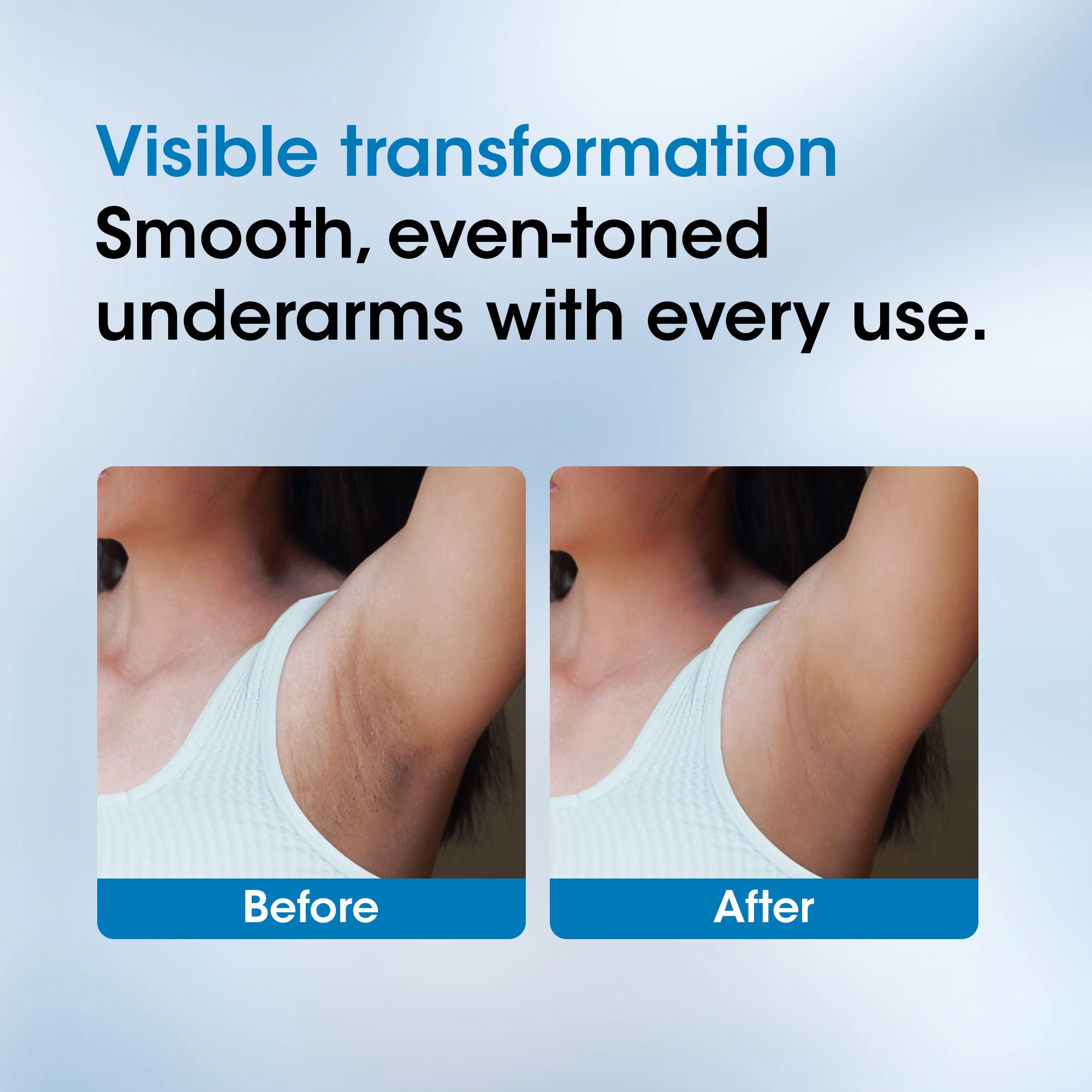 OG BEAUTY Science+ AHA BHA Underarm Roll On | 2% Lactic 1% Salicylic 1% Mandelic Acid 1% Alpha Arbutin | Lightens Dark Spots & Controls Odour | 50ml - Image 5